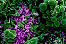 Particelle del virus SarsCoV2 (in violetto) sulla superficie di una cellula (fonte: NIAID)